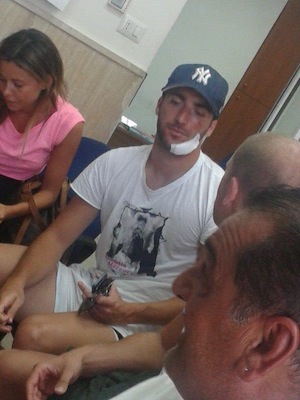 Higuain cade dagli scogli a Capri, due punti al sopracciglio ed otto alla mandibola